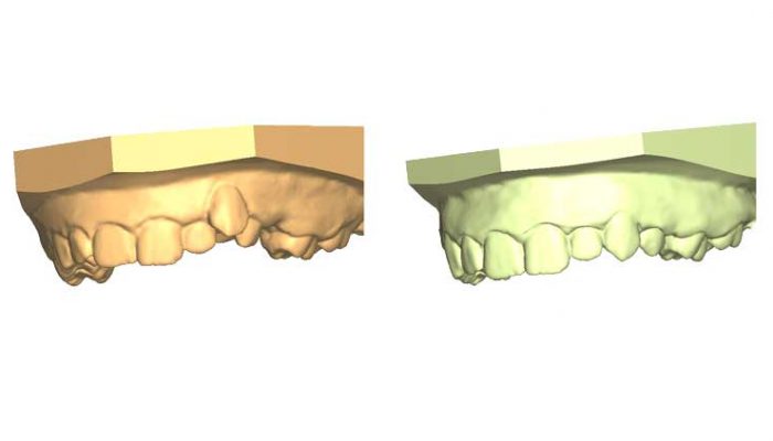 Abnormal Eruption Six Sessions