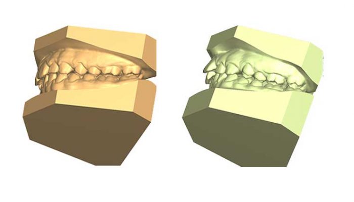 Correct Alignment Four Sessions
