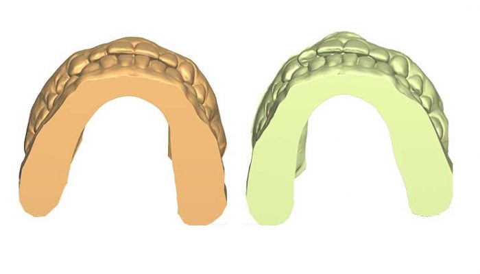 Little corrections after other braces Two Sessions