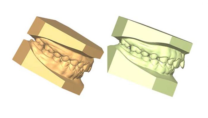 Correct Alignment Four Sessions