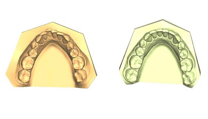 Crowding Seven Sessions