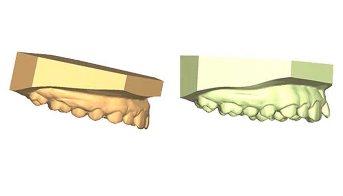 Correct Alignment Four Sessions