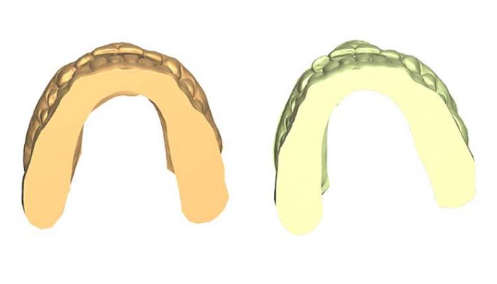 Little corrections after other braces Two Sessions