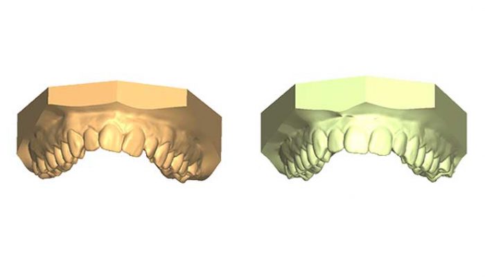 Crowding Seven Sessions (Top), Five Sessions (Down)