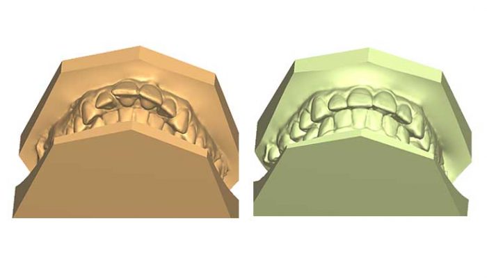 Open bite Seven Sessions