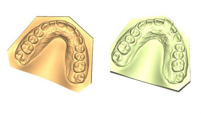 Correct Alignment Four Sessions