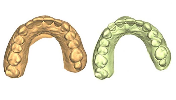 Little corrections after other braces Two Sessions