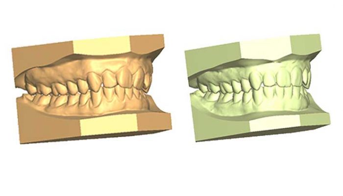 Crowding Seven Sessions (Top), Five Sessions (Down)
