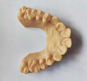 Clearaligner-Nightguard