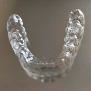 Claeraligner Retainer